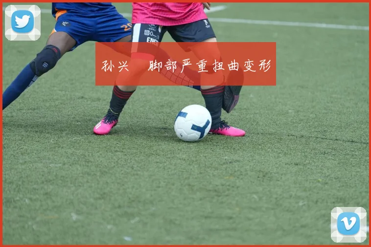 孙兴慜脚部严重扭曲变形